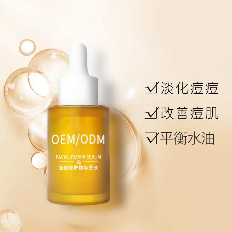 鹰潭市_祛痘精华原液OEM